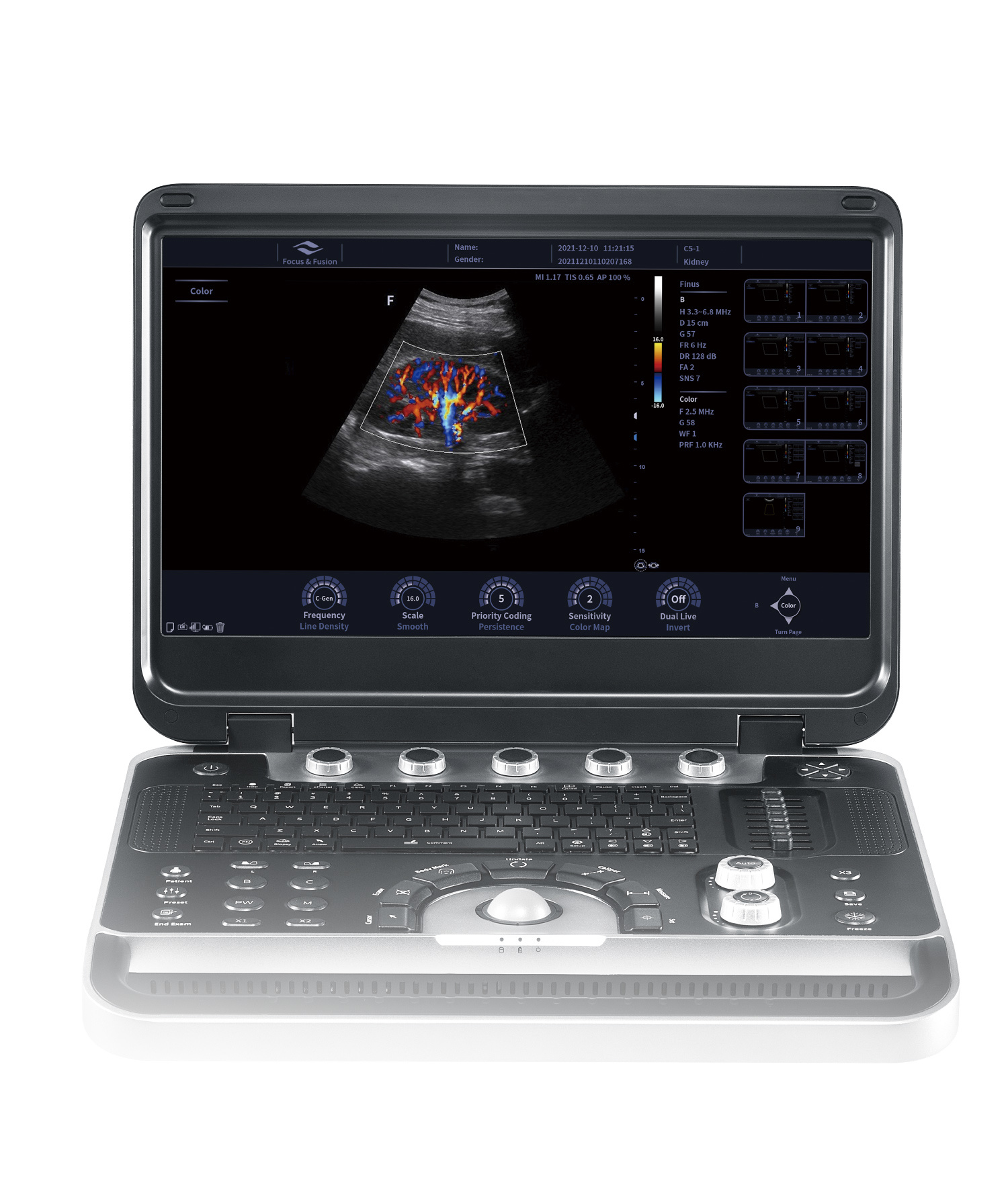 Focus & Fusion Finus 50 portable ultrasound system