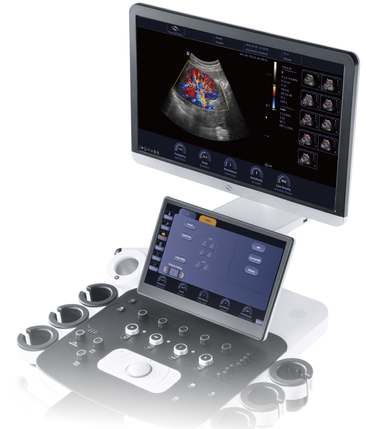 Ultrasound